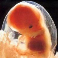 Un embrión humano