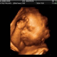 La Organización Mundial de la Salud publica un documento para promover el «aborto seguro»