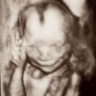 Imagen de un feto de 17 semanas sonriendo