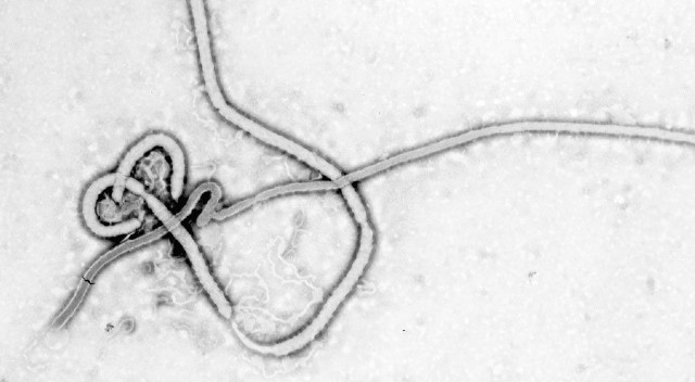 Caritas Italia denuncia que en los últimos años faltó interés por vacuna contra el Ébola