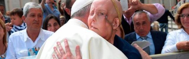 Charyl Tobin tiene un cáncer peculiar que ha deformado su rostro y le acerca al final de su vida - foto de Osservatore Romano