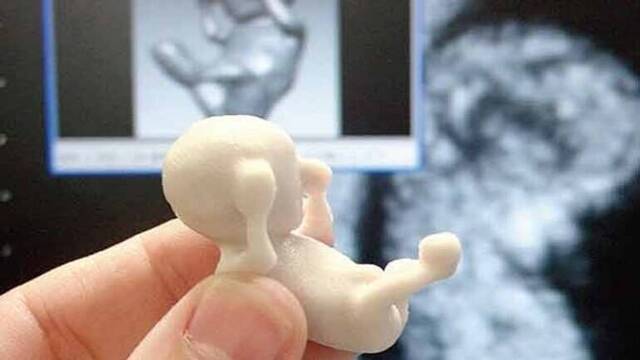 Representación de un feto de 11 semanas.