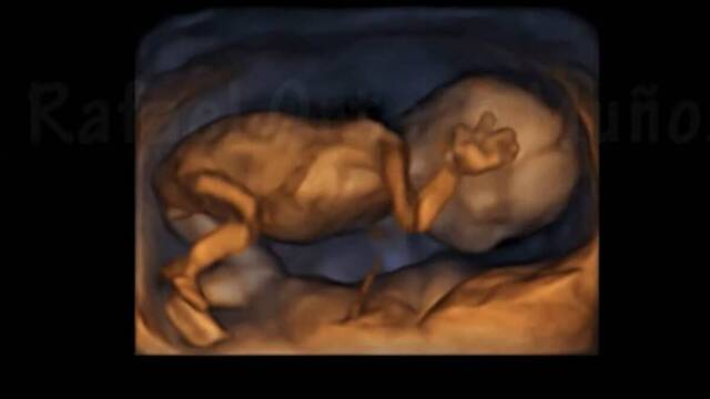 Ecografía 4D de un feto de 14 semanas.