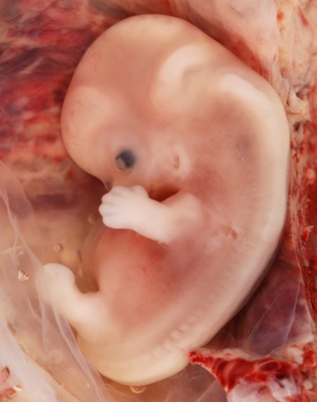 Embrión de 9 semanas.