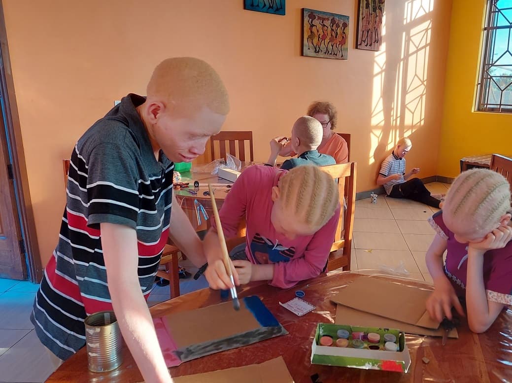 Chicos albinos acogidos en la casa de los misioneros SMA en Mwanga, Tanzania