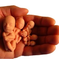 Varios fetos