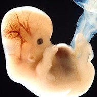 Embrión de 6 semanas.