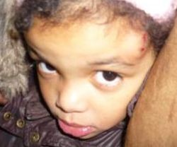 Niña de 4 años atacada por una banda de abortistas