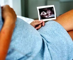 La obligación de mostrar a la madre una ecografía de su hijo ha hundido decenas de clínicas abortistas en Texas.