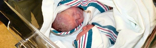 Las dos pequeñas nacieron sanas y siguen sanas, y ahora su historia prenatal se ha convertido en viral gracias al espectacular vídeo de la operación que las salvó.