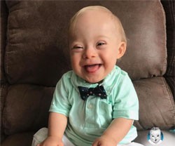 La «sonrisa y la expresión alegre» de un niño con síndrome de Down, nueva imagen de Gerber