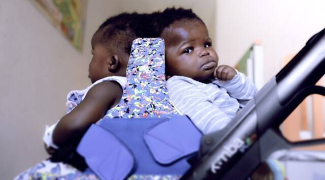 Las gemelas centroafricanas antes de ser separadas en una operación especialísima en el Hospital infantil de la Santa Sede