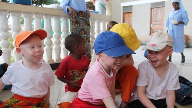Niños albinos.