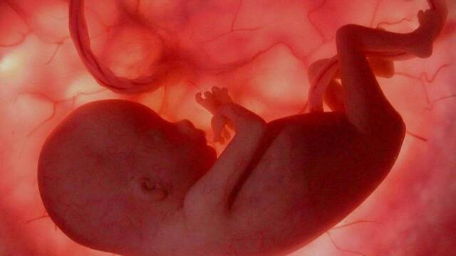 Imagen de un feto