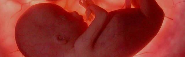 Imagen de un feto