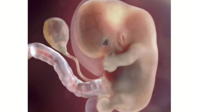 Embrión de 8 semanas.