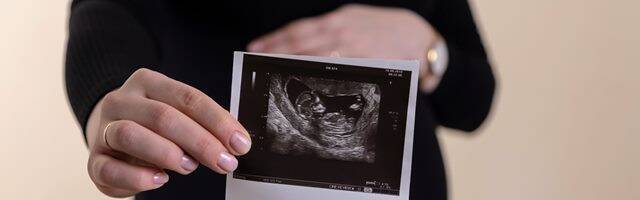 Mujer embarazada muestra una ecografía de su bebé.