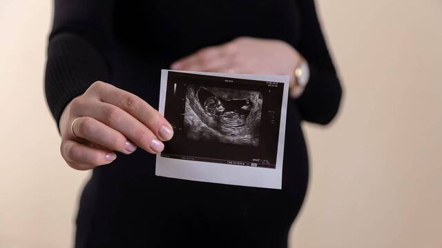 Mujer embarazada muestra una ecografía de su bebé.