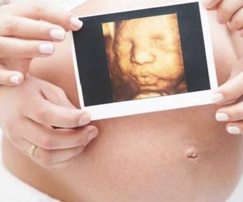 «Si decide abortar a su bebé, primero deberá escuchar el latido», se añade en la ley húngara provida