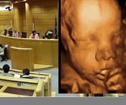 El Senado español endurece la Ley del Aborto para que no se informe casi nada a la embarazada sobre riesgos o alternativas